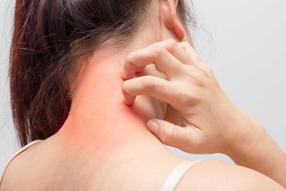 Dermatite é um dos tipos mais comuns de alergias cutâneas, mas tem tratamento e controle - Foto: Shutterstock